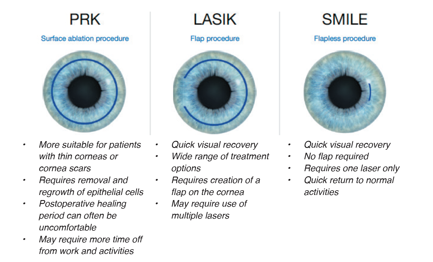 Коррекция зрения методом смайл. LASIK smile. LASIK, PRK И smile. Смайл и ласик сравнение. Лазерная коррекция зрения LASIK.